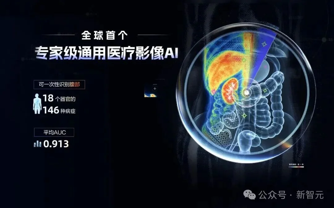 Hinton错了！中国AI登顶Science，全球首个专家级通用影像AI来了